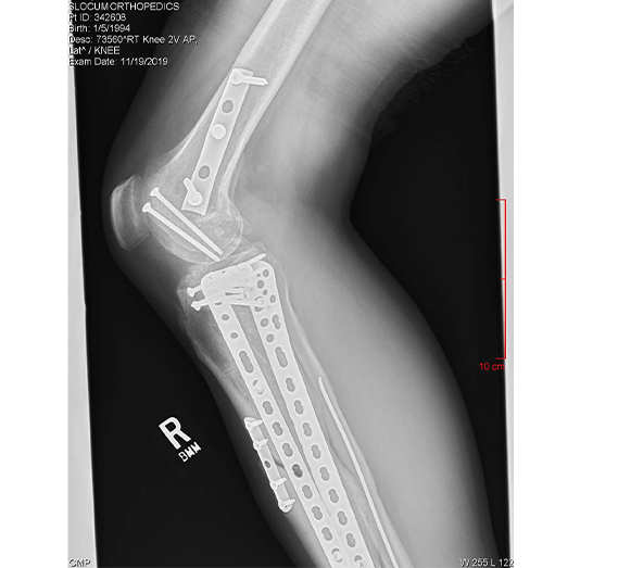 Unsafe-Truck-Case-Injuries-4